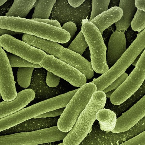 Sanitización y Desinfección